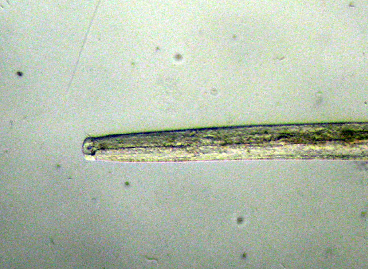 Microscopia delle spiagge adriatiche
